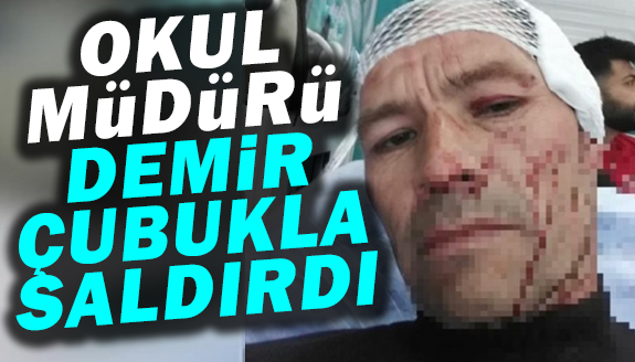 Okuldaki tartışma kanlı bitti: Müdür demir çubukla saldırdı!