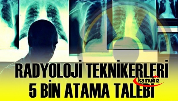 80 bin radyoloji teknikeri 5 bin atama bekliyor