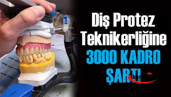 Diş Proteze 3000 Kadro Şart!