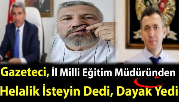 İl Milli Eğitim Müdüründen Helallik İsteyince, Dayak Yedi!